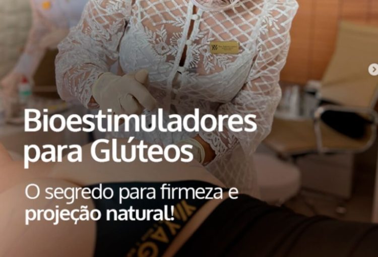Bioestimuladores para Glúteos: O segredo para a firmeza e projeção natural!