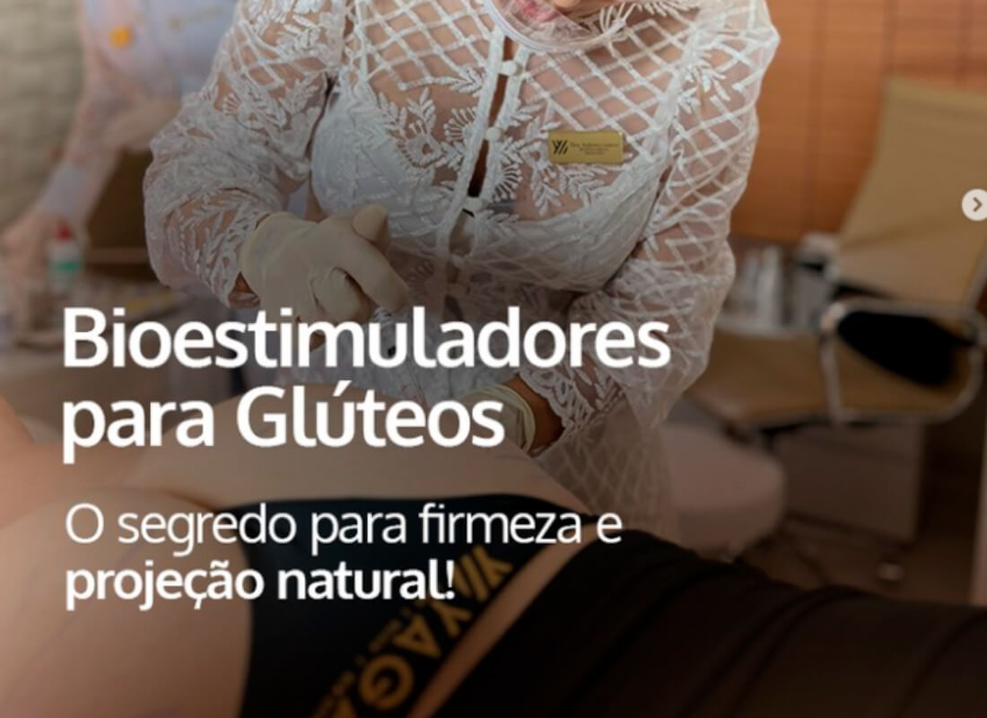 Bioestimuladores para Glúteos: O segredo para a firmeza e projeção natural!