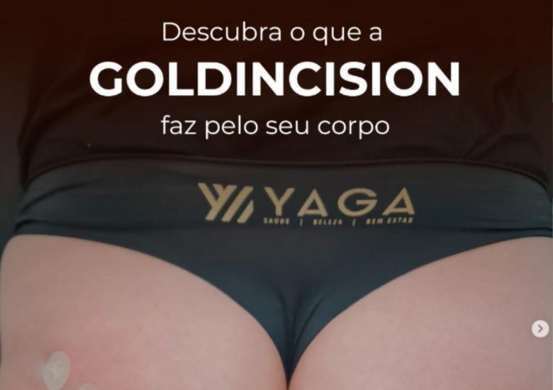 Descubra o que a GoldIncision faz pelo seu corpo