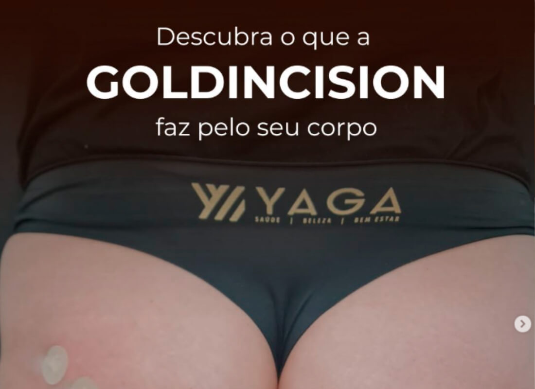 Descubra o que a GoldIncision faz pelo seu corpo