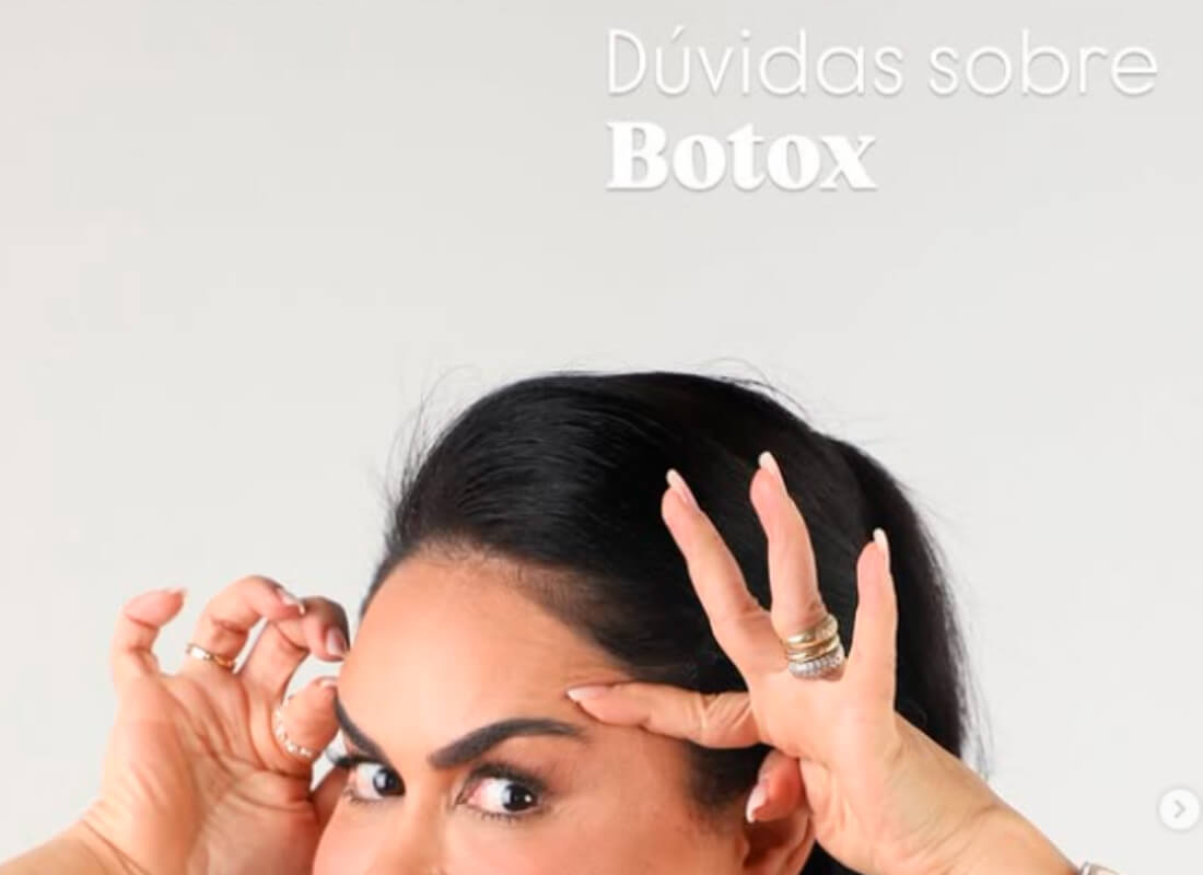 Dúvidas sobre o Botox