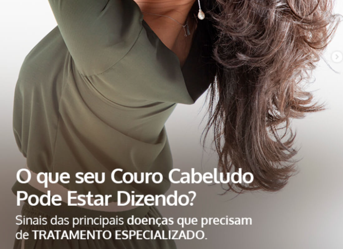 O que o seu Couro Cabeludo Pode Estar Dizendo