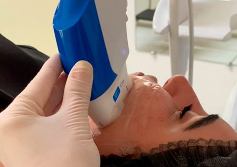 Lifting sem cortes: a tecnologia que reposiciona e estimula a pele de forma natural