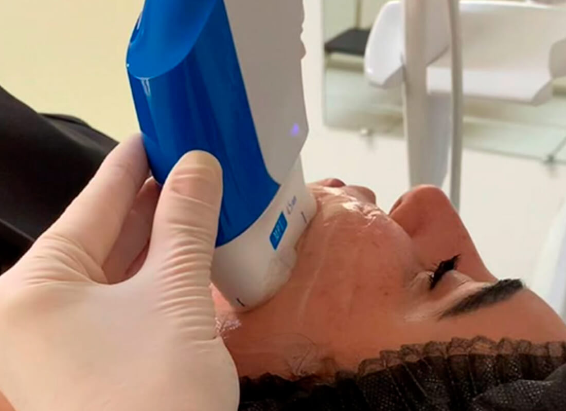 Lifting sem cortes: a tecnologia que reposiciona e estimula a pele de forma natural