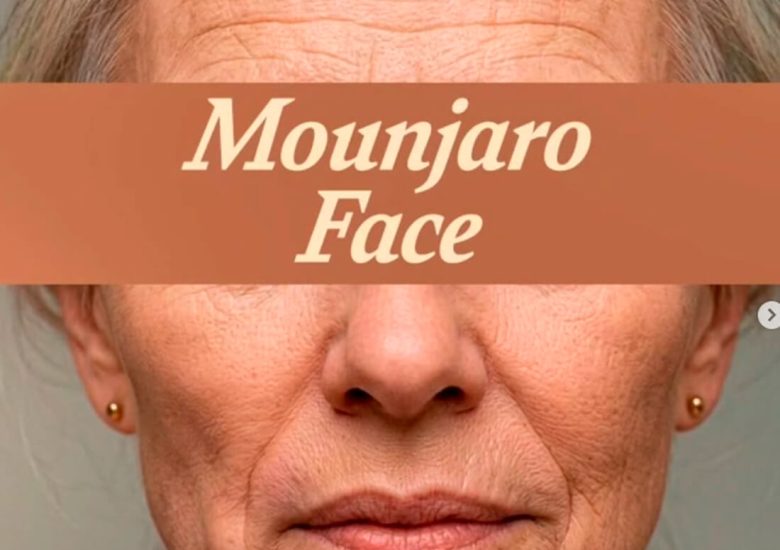 Mounjaro Face