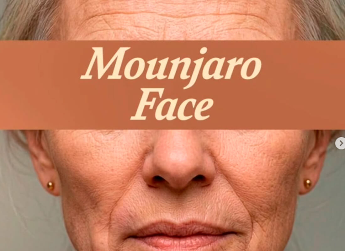 Mounjaro Face