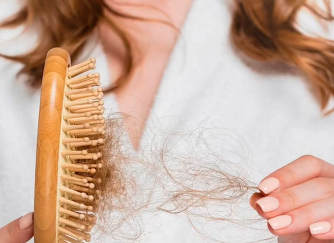 Seu cabelo continua caindo mesmo com os exames normais?