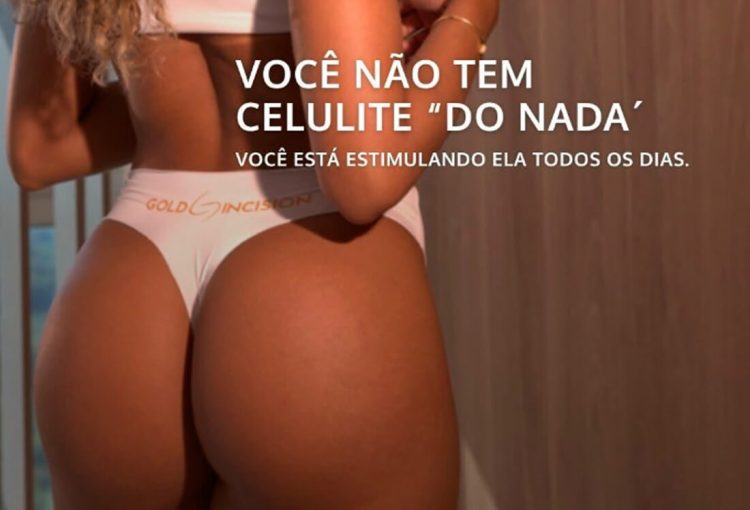 Você não tem celulite “do nada”