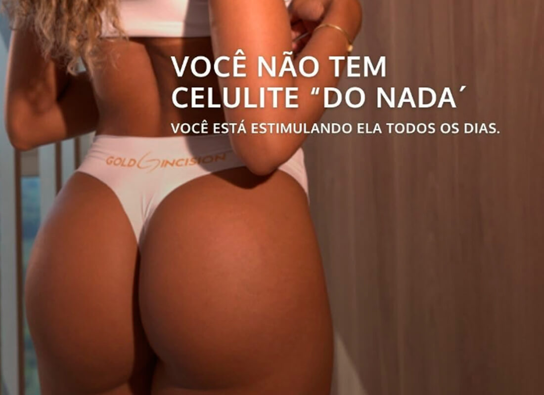 Você não tem celulite “do nada”