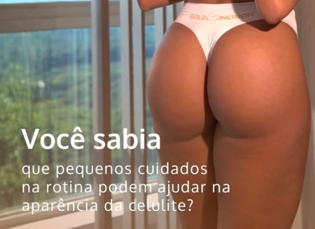 Você sabia que pequenos cuidados na rotina podem ajudar na aparência da celulite?