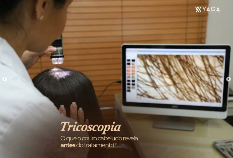 Tricoscopia, o que o curo cabeludo revela antes do tratamento