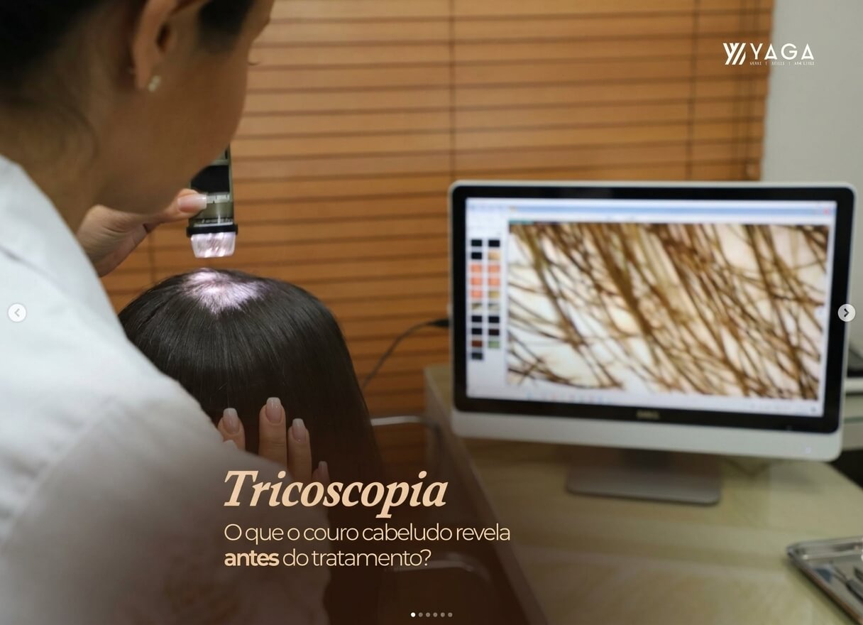 Tricoscopia, o que o curo cabeludo revela antes do tratamento